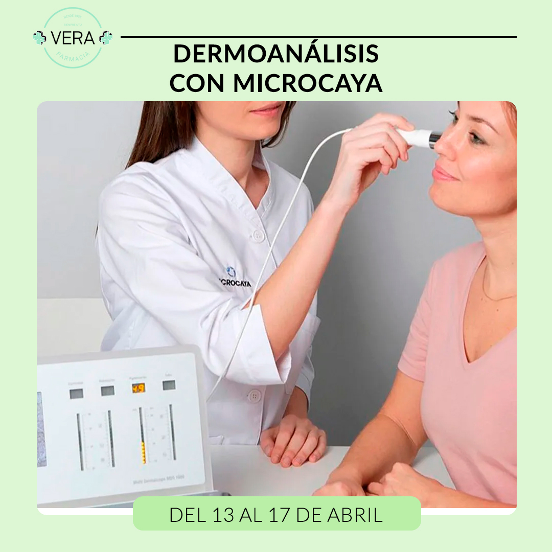 DERMOANALISIS CON MICROCAYA