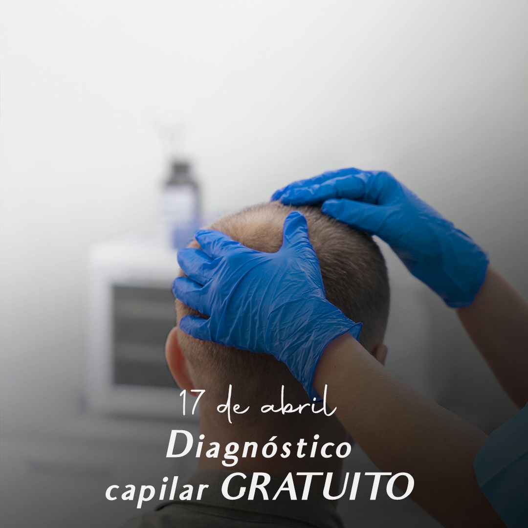 IMD JORNADA DE ANALISIS CAPILAR GRATUITO