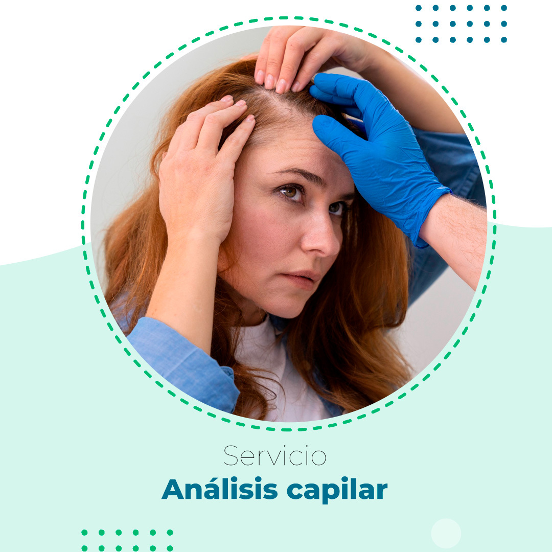 ANÁLISIS CAPILAR