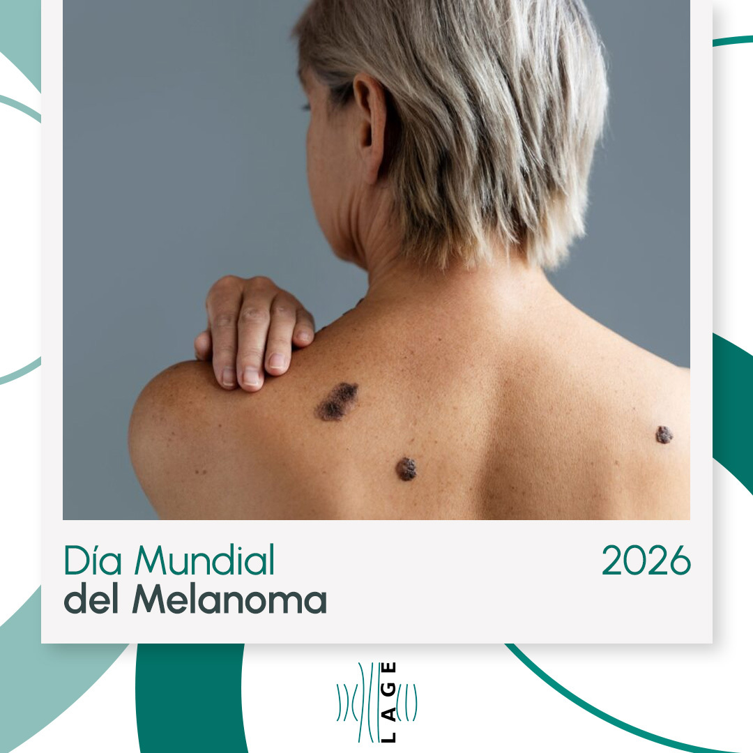DÍA MUNDIAL DEL MELANOMA