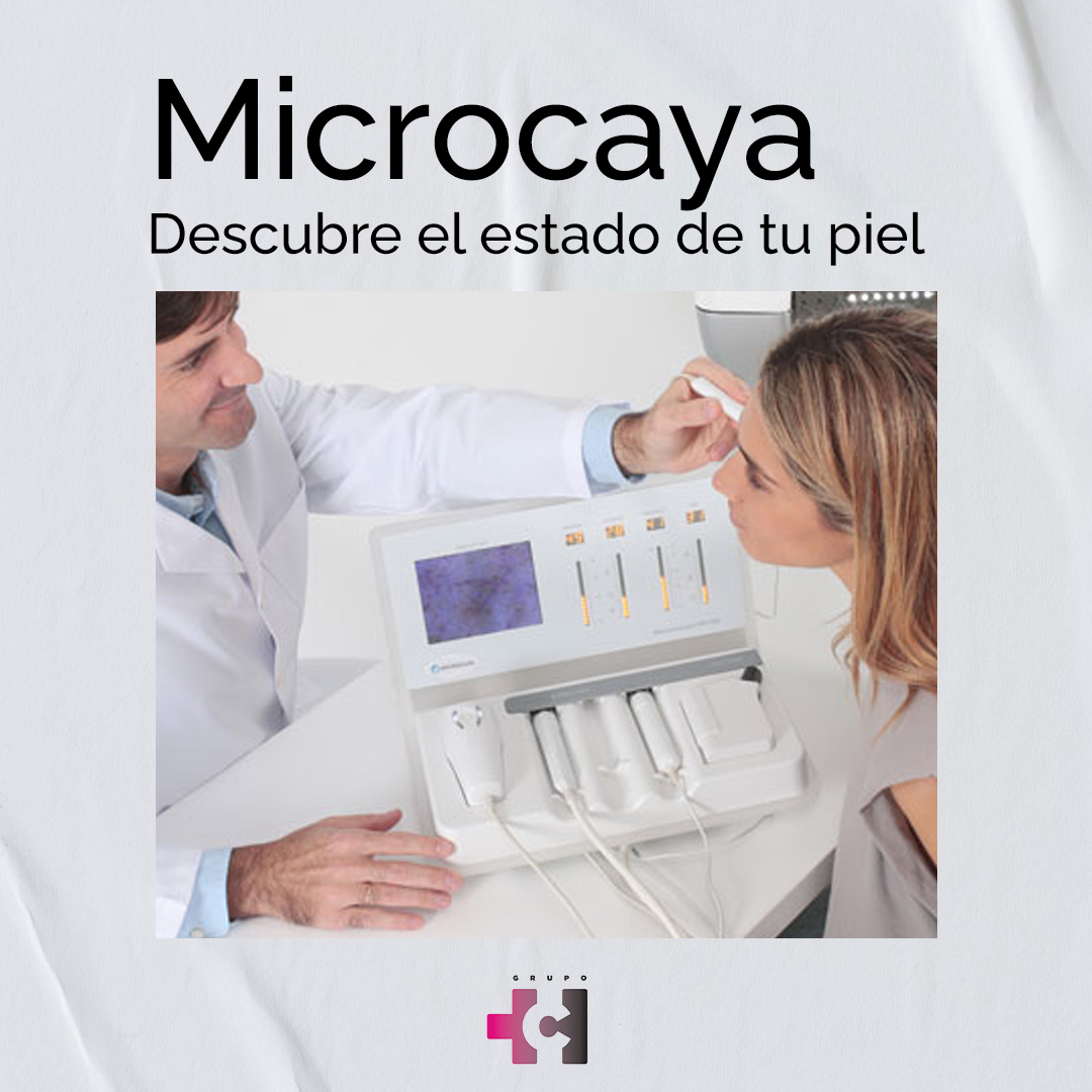 MICROCAYA